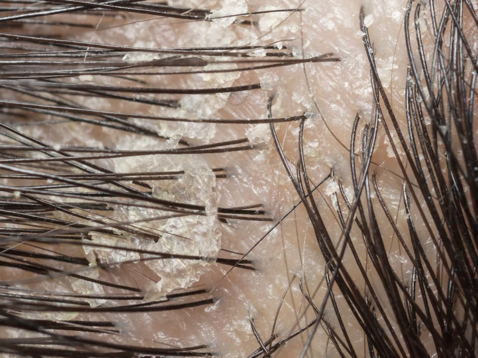 How to deal with itchy scalp wounds: Your ultimate guide - THE EVERY